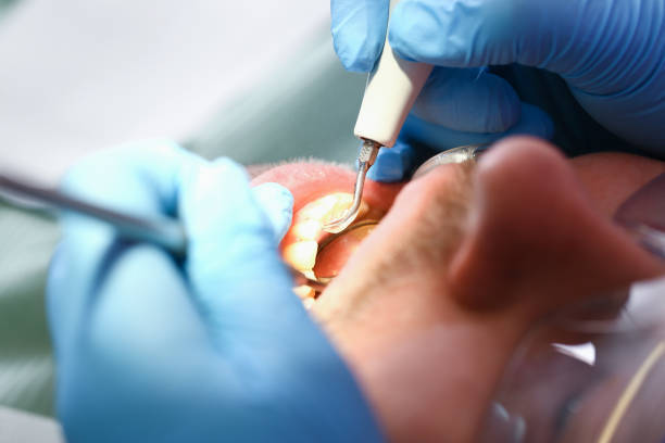 Best Broken or Cracked Tooth Emergency Dentist in West Richland, WA